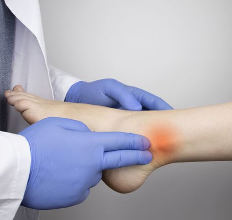 Plantar fasciitis Plantar fasciitis